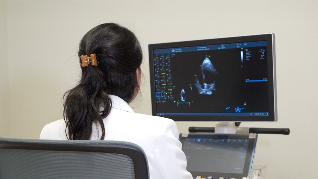 Echocardiography: Pemeriksaan Kunci untuk Menemukan Kelainan Jantung Sejak Dini