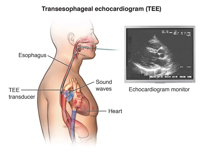 Ekokardiografi - Jenis, Prosedur, & Efek Sampingnya