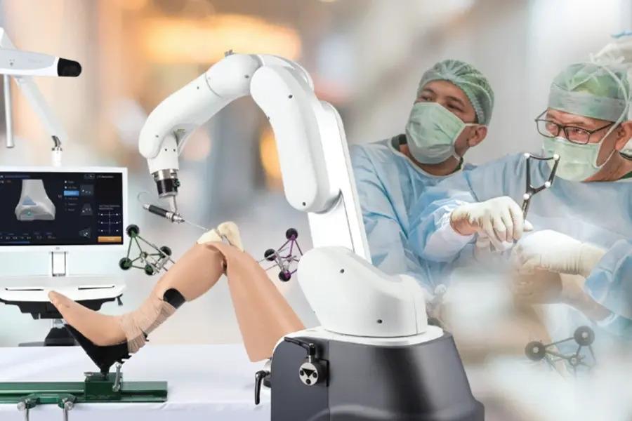 Kenali Operasi Lutut Robotik, Inovasi Medis dengan Tingkat Presisi Tinggi