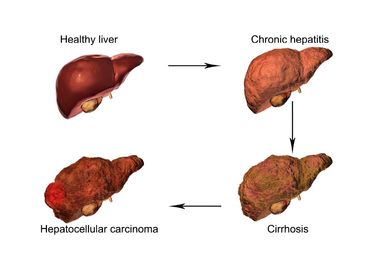 15 Tanda Jantung Sehat, Denyut Normal hingga Napas Lancar