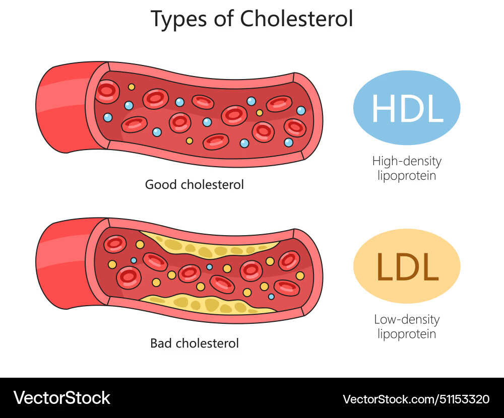 Kolesterol LDL: Penyebab & 5 Risiko Penyakit yang Mengintai