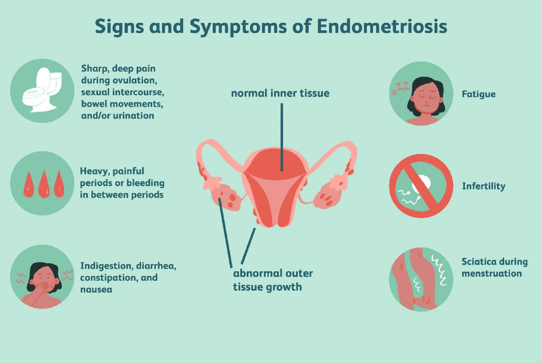 10 Ciri-ciri Endometriosis yang Perlu Diwaspadai!