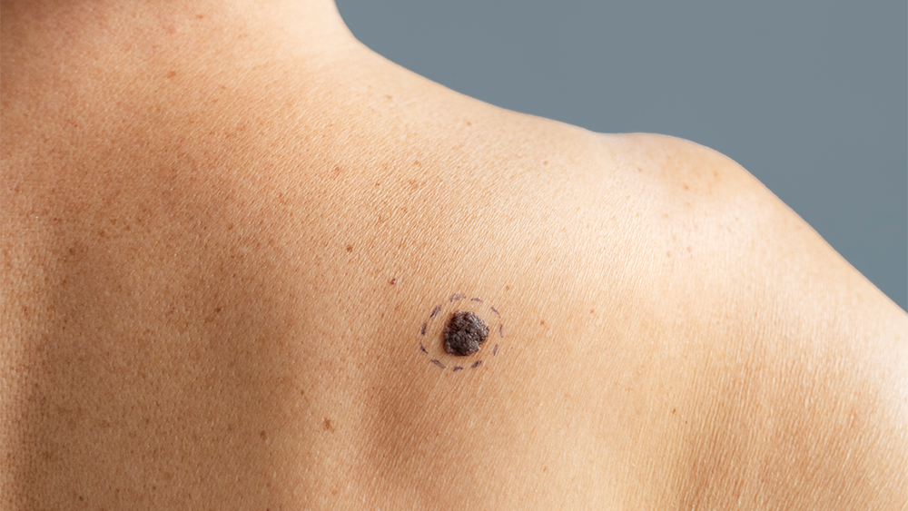 artikel feature image