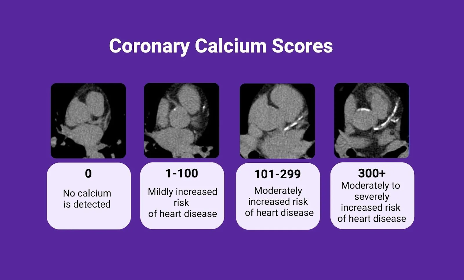CT Calcium Score – Prosedur, Interpretasi, Biaya & Cara Menurunkan