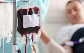 15 Efek Samping Transfusi Darah, Ringan Hingga yang Fatal!